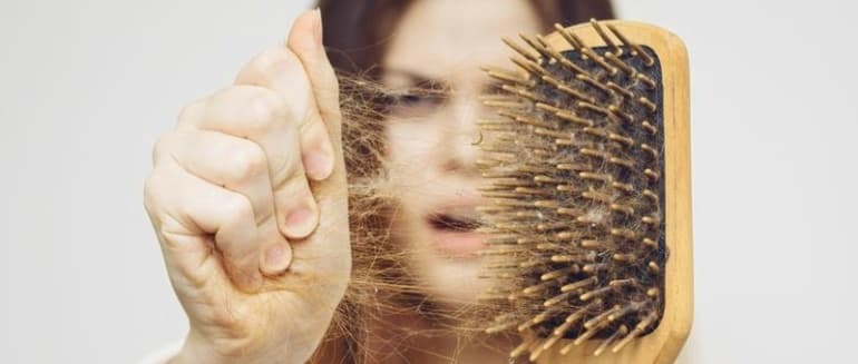 Plaukų slinkimas: priežastys ir gydymo būdai